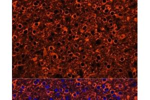 Immunofluorescence analysis of Mouse brain using TUBB3 Polyclonal Antibody at dilution of 1:100. (TUBB3 抗体)
