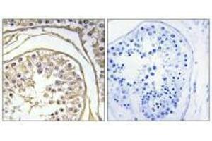 Immunohistochemistry analysis of paraffin-embedded human testis tissue using BAGE2 antibody. (BAGE2 抗体)
