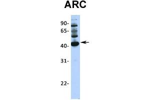 Host:  Rabbit  Target Name:  ARC  Sample Type:  293T  Antibody Dilution:  1. (ARC (Middle Region) 抗体)