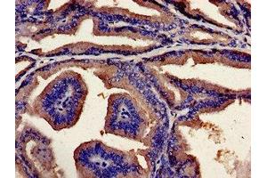 Immunohistochemistry analysis of human prostate tissue using ABIN7174228 at dilution of 1:100 (Ubiquilin 2 抗体  (AA 473-542))