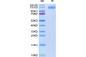 SDS-PAGE (SDS) image for SARS-CoV-2 Spike S1 (B.1.640) protein (His tag) (ABIN7274872)