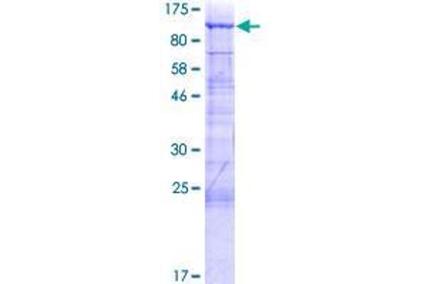 GGN Protein (AA 1-652) (GST tag)