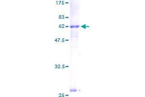 Image no. 1 for Acetyl-CoA Acetyltransferase 2 (ACAT2) (AA 1-397) protein (GST tag) (ABIN1305614) (ACAT2 Protein (AA 1-397) (GST tag))