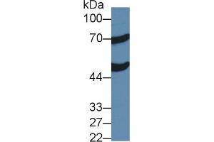 Detection of ACOX1 in Mouse Liver lysate using Polyclonal Antibody to Acyl Coenzyme A Oxidase 1, Palmitoyl (ACOX1) (ACOX1 抗体  (AA 210-409))