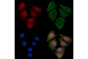 ABIN6259232 and ABIN6275659 staining Hela cells by IF/ICC. (USP45 抗体  (Internal Region))