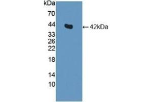 Detection of Recombinant INS, Canine using Polyclonal Antibody to Insulin (INS) (Insulin 抗体  (AA 25-110))