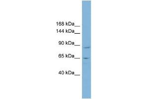 WB Suggested Anti-MGC16169 Antibody Titration:  0. (TBCK 抗体  (Middle Region))