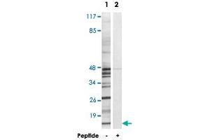 Western blot analysis of extracts from K-562 cells, using MRPS18C polyclonal antibody . (MRPS18C 抗体)