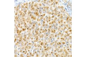 Immunohistochemistry of paraffin-embedded rat ovary using Cation-independent M6PR (IGF2R) antibody (ABIN7267905) at dilution of 1:200 (40x lens). (IGF2R 抗体)
