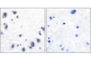 Immunohistochemistry (IHC) image for anti-Tyrosine Hydroxylase (TH) (AA 41-90) antibody (ABIN1532224)