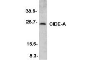Western blot analysis of CIDE-A in mouse heart tissue lysate with AP30230PU-N CIDE-A antibody at 1/500 dilution. (CIDEA 抗体  (C-Term))