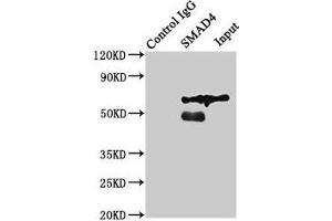 Immunoprecipitating SMAD4 in Jurkat whole cell lysate Lane 1: Rabbit control IgG (1 μg) instead of ABIN7160238 in Jurkat whole cell lysate. (SMAD4 抗体  (AA 27-195))