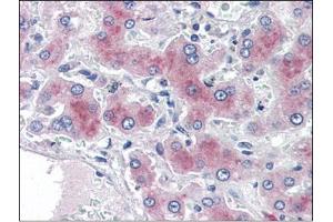Human Liver (formalin-fixed, paraffin-embedded) stained with PCK1at 2 µg/ml followed by biotinylated anti-goat IgG secondary antibody, alkaline phosphatase-streptavidin and chromogen. (PCK1 抗体  (Internal Region))