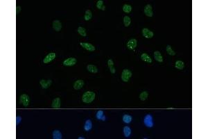 Immunofluorescence analysis of U-2 OS cells using MKL1 Polyclonal Antibody at dilution of 1:100 (40x lens). (MKL1 抗体)