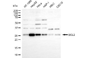 Western blotting analysis using BCL2 antibody (ABIN7797720).