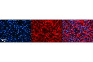 Rabbit Anti-FKBP8 Antibody Catalog Number: ARP46862_P050 Formalin Fixed Paraffin Embedded Tissue: Human Liver Tissue Observed Staining: Cytoplasm in hepatocytes Primary Antibody Concentration: 1:100 Other Working Concentrations: N/A Secondary Antibody: Donkey anti-Rabbit-Cy3 Secondary Antibody Concentration: 1:200 Magnification: 20X Exposure Time: 0. (FKBP8 抗体  (N-Term))