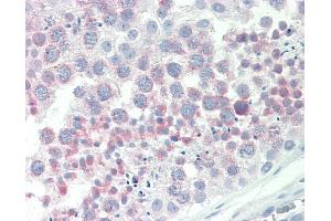 Anti-IGFBP1 antibody IHC staining of human testis. (IGFBPI 抗体  (AA 156-170))