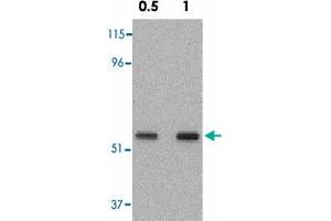Western blot analysis of SKIL in A-431 cell lysate with SKIL polyclonal antibody  at 0. (SKIL 抗体  (N-Term))