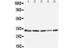 Western Blotting (WB) image for anti-Tumor Necrosis Factor, alpha-Induced Protein 8-Like 3 (TNFAIP8L3) (AA 273-292), (C-Term) antibody (ABIN3042574) (TNFAIP8L3 抗体  (C-Term))