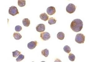 Image no. 2 for anti-Tumor Necrosis Factor Receptor Superfamily, Member 10a (TNFRSF10A) (C-Term) antibody (ABIN201644)