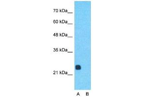 Host:  Rabbit  Target Name:  RCAN1  Sample Type:  Human Fetal Muscle  Lane A:  Primary Antibody  Lane B:  Primary Antibody + Blocking Peptide  Primary Antibody Concentration:  1ug/ml  Peptide Concentration:  5ug/ml  Lysate Quantity:  25ug/lane/lane  Gel Concentration:  0. (RCAN1 抗体  (Middle Region))