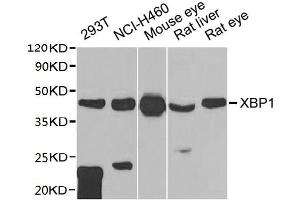 Western blot All lanes: XBP1 antibody at 1:1000 dilution Lane 1: 293T whole cell lysate Lane 2: NCI-H460 whole cell lysate Lane 3: Mouse eye tissue Lane 4: Rat liver tissue Lane 5: Rat eye tissue Secondary Goat polyclonal to rabbit IgG at 1/10000 dilution Predicted band size: 29, 41 kDa Observed band size: 41 kDa (XBP1 抗体  (AA 1-261))