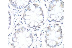 Immunohistochemistry of paraffin-embedded Human colon using SDHB Polyclonal Antibody at dilution of 1:100 (40x lens). (SDHB 抗体)