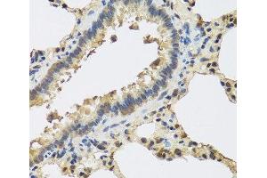 Immunohistochemistry of paraffin-embedded Rat lung using IL25 Polyclonal Antibody at dilution of 1:100 (40x lens). (IL-25 抗体)