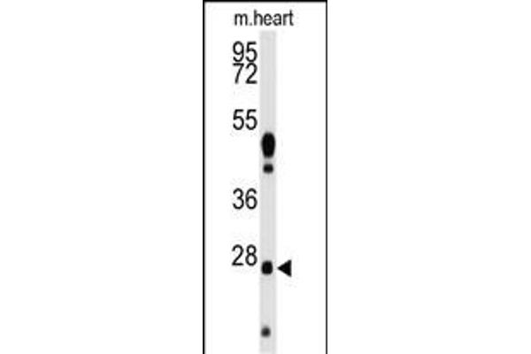 WDYHV1 antibody  (AA 106-136)