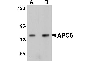 Western Blotting (WB) image for anti-Anaphase Promoting Complex Subunit 5 (ANAPC5) (Middle Region) antibody (ABIN1030862) (ANAPC5 抗体  (Middle Region))