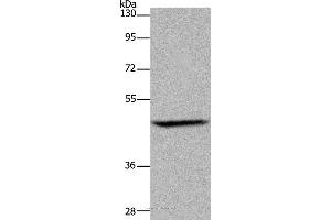 Western blot analysis of Mouse brain tissue, using ETS2 Polyclonal Antibody at dilution of 1:500 (ETS2 抗体)