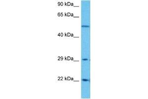 Western Blotting (WB) image for anti-Solute Carrier Family 25 (Mitochondrial Carrier, Adenine Nucleotide Translocator), Member 4 (SLC25A4) (N-Term) antibody (ABIN2781568)