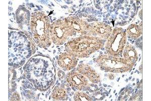 Image no. 3 for anti-Homeobox D3 (HOXD3) (AA 80-129) antibody (ABIN6735792) (HOXD3 抗体  (AA 80-129))