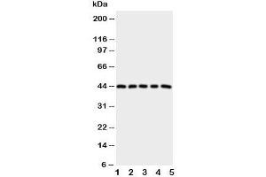 Western blot testing of PGE Receptor antibody and Lane 1:  HeLa;  2: A549;  3: MCF-7;  4: MM231;  5: MM453 cell lysate (PTGER1 抗体  (C-Term))