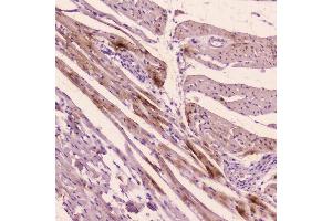 IHC analysis of ANP using anti-ANP antibody (ABIN5693163). (NPPA 抗体  (AA 25-122))