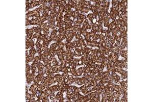 Immunohistochemical staining of human liver with PPP1R12C polyclonal antibody  shows strong cytoplasmic positivity in hepatocytes. (PPP1R12C 抗体)