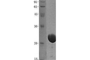 Validation with Western Blot (UCHL1 Protein (His tag))