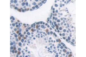 Used in DAB staining on fromalin fixed paraffin- embedded testis tissue (BRD1 抗体  (AA 579-1058))
