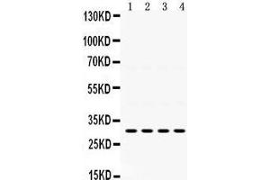 Western Blotting (WB) image for anti-Insulin-Like Growth Factor Binding Protein 3 (IGFBP3) (AA 214-252), (C-Term) antibody (ABIN3043859) (IGFBP3 抗体  (C-Term))
