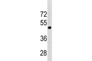 TGFBR1 antibody western blot analysis in mouse Neuro-2a lysate (TGFBR1 抗体  (AA 145-172))