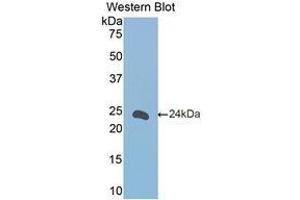 Western Blotting (WB) image for anti-Fc Fragment of IgE, Low Affinity II, Receptor For (CD23) (FCER2) (AA 150-330) antibody (ABIN1174800)