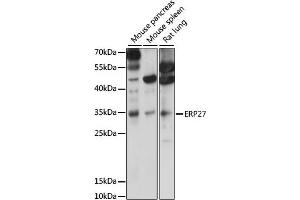 Western blot analysis of extracts of various cell lines, using ERP27 antibody (ABIN7266942) at 1000 dilution. (ERP27 抗体  (AA 1-273))