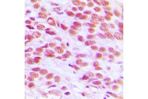 Immunohistochemistry (IHC) image for anti-H2A Histone Family, Member X (H2AFX) (C-Term) antibody (ABIN7295864)