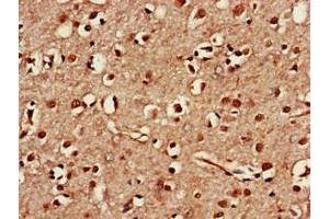 Immunohistochemistry of paraffin-embedded human brain tissue using ABIN7171556 at dilution of 1:100 (TAF1A 抗体  (AA 251-325))
