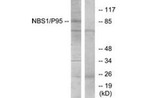 Western blot analysis of extracts from Jurkat cells, using p95/NBS1 (Ab-343) Antibody. (Nibrin 抗体  (AA 310-359))
