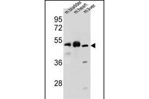 BTBD17 Antibody (C-term) (ABIN655567 and ABIN2845068) western blot analysis in mouse bladder,heart,liver tissue lysates (35 μg/lane). (BTBD17 抗体  (C-Term))