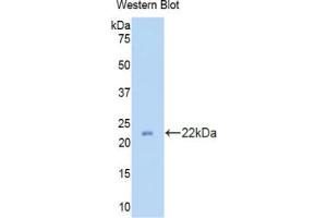 Western blot analysis of the recombinant protein. (Peroxiredoxin 2 抗体  (AA 6-164))