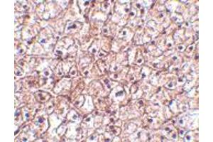 Immunohistochemistry of IFNB1 in human liver tissue with IFNB1 polyclonal antibody  at 5 ug/mL . (IFNB1 抗体  (Internal Region))
