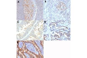Immunohistochemical staining (Formalin-fixed paraffin-embedded sections) of human tonsil (A), human pancreas (B), human colon carcinoma (C), human rectal carcinoma (D) and human duodenum (E) with ABCC1 monoclonal antibody, clone MRP1/1343 . (ABCC1 抗体)