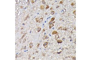 Immunohistochemistry of paraffin-embedded mouse spinal cord using MTHFD1L Rabbit pAb (ABIN6132366, ABIN6144142, ABIN6144143 and ABIN6223977) at dilution of 1:200 (40x lens). (MTHFD1L 抗体  (AA 759-978))